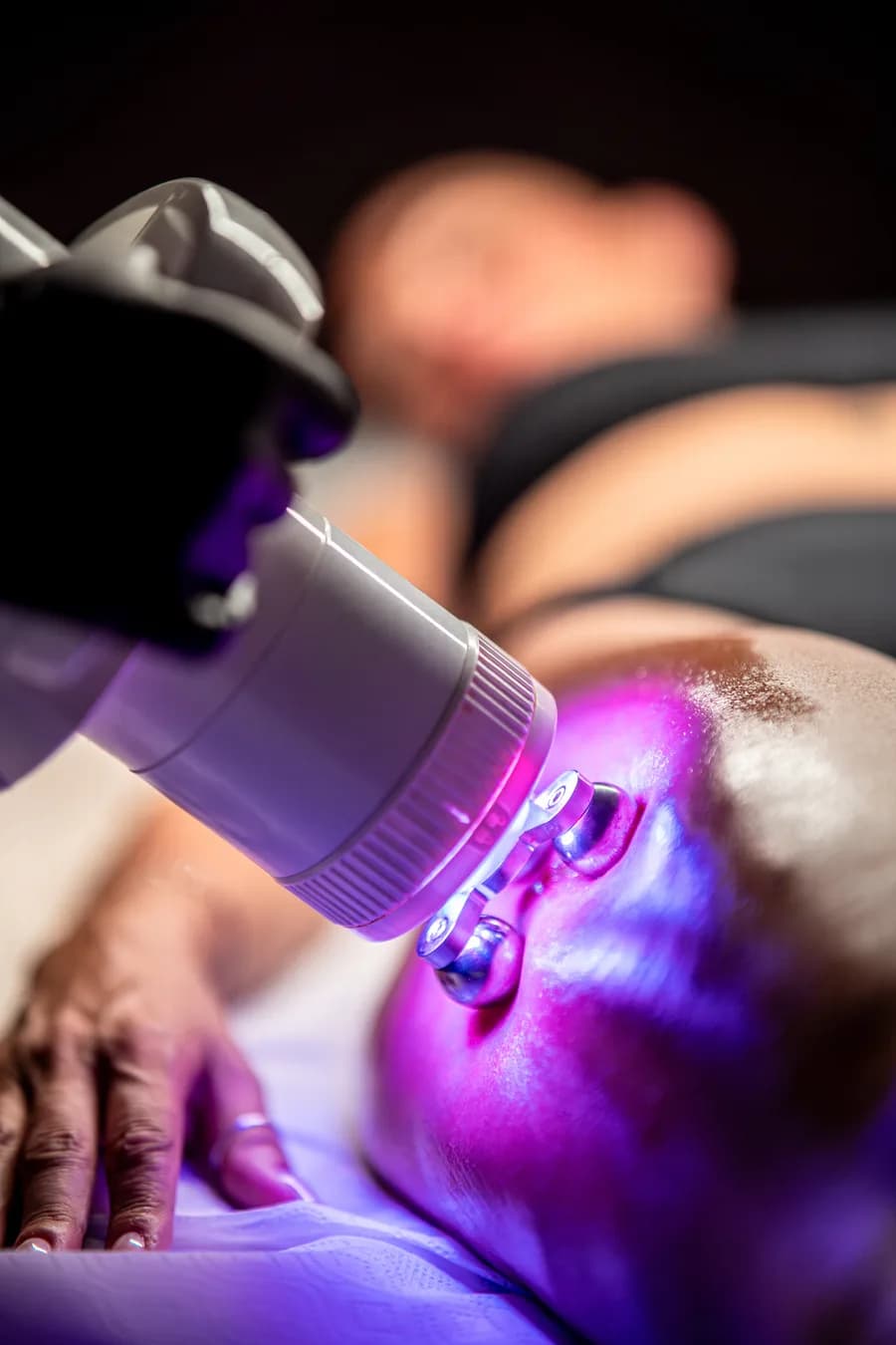 Trattamento laser